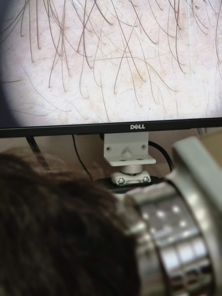 UNIDAD Micoscopia Epiluminiscencia . otras utilidades. tricoscopia 2