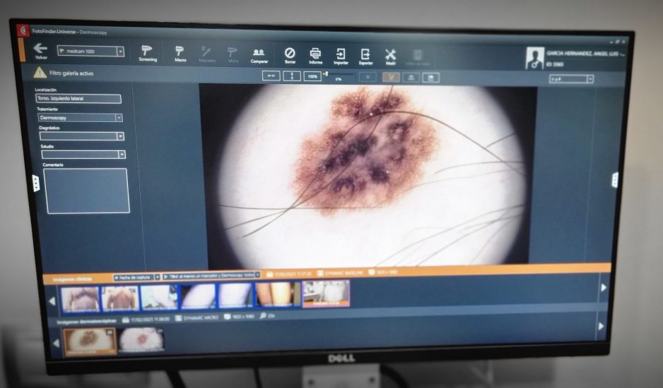 UNIDAD Micoscopia Epiluminiscencia 1. en MAYOR PRECISION